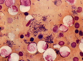 人食いバクテリア　画像.png